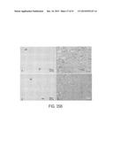 Methods and Compositions for Treating Trauma-Hemorrhage Using Estrogen and     Derivatives Thereof diagram and image