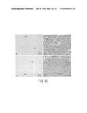 Methods and Compositions for Treating Trauma-Hemorrhage Using Estrogen and     Derivatives Thereof diagram and image