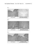 PHARMACEUTICAL OR FOOD COMPOSITION COMPRISING OLDENLANDIA BRACHYPODA,     SPERGULARIA MARINA, DISPORUM SMILACINUM, PERSICARIA POSUMBU, OR GEUM     ALEPPICUM diagram and image