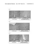 PHARMACEUTICAL OR FOOD COMPOSITION COMPRISING OLDENLANDIA BRACHYPODA,     SPERGULARIA MARINA, DISPORUM SMILACINUM, PERSICARIA POSUMBU, OR GEUM     ALEPPICUM diagram and image