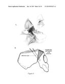 COMPOSITIONS AND METHODS FOR REGENERATION OF HARD TISSUES diagram and image