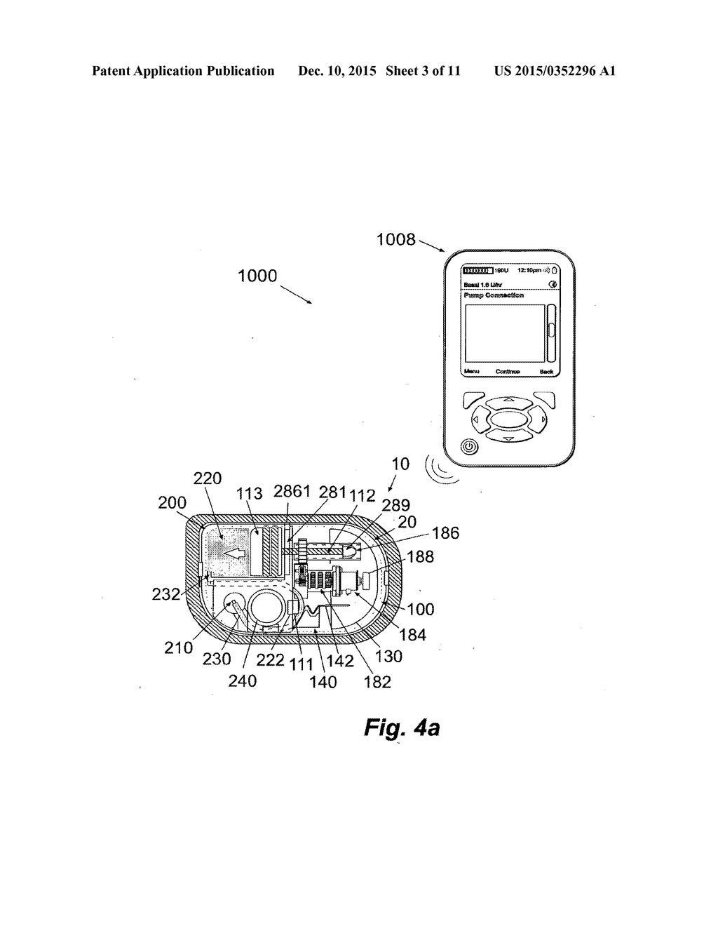 DEVICE, A SYSTEM AND A METHOD FOR IDENTIFICATION/AUTHENTICATION OF PARTS     OF A MEDICAL DEVICE - diagram, schematic, and image 04