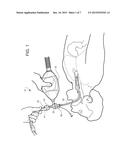 DEVICE HAVING MANUAL RESUSCITATION AND SUCTION CAPABILITIES diagram and image