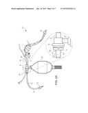 DEVICE HAVING MANUAL RESUSCITATION AND SUCTION CAPABILITIES diagram and image