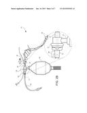 DEVICE HAVING MANUAL RESUSCITATION AND SUCTION CAPABILITIES diagram and image