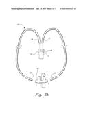 VENTILATION INTERFACE FOR SLEEP APNEA THERAPY diagram and image