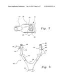 VENTILATION INTERFACE FOR SLEEP APNEA THERAPY diagram and image