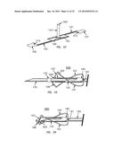 NEEDLE GUARD diagram and image