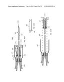 NEEDLE GUARD diagram and image