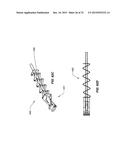 NEEDLE GUARD diagram and image