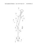 SURGICAL DEVICE FOR PERFORMING A SPHENOPALATINE GANGLION BLOCK PROCEDURE diagram and image