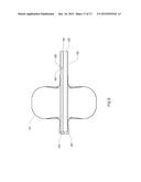 SURGICAL DEVICE FOR PERFORMING A SPHENOPALATINE GANGLION BLOCK PROCEDURE diagram and image