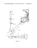 BALLOON CATHETER INFLATION APPARATUS AND METHODS diagram and image