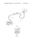 METHOD AND APPARATUS FOR FLUID DELIVERY diagram and image