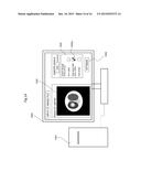 PARTICLE THERAPY SYSTEM diagram and image