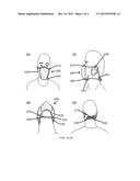 RESPIRATORY PROTECTION DEVICE diagram and image