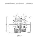 COMPRESSIBLE BAFFLE FOR A FUEL TANK diagram and image