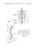 ADJUSTABLE SEAT ASSEMBLY diagram and image