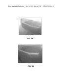 COMPOSITIONS FOR LABELING NERVES AND METHODS OF USE diagram and image