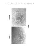 NUCLEIC ACIDS ENCODING PEPTIDES FOR TREATING WOUNDS, ANTI-ANGIOGENIC     COMPOUNDS AND USES THEREOF diagram and image