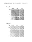 C-TERMINAL AND CENTRAL EPITOPE A-BETA ANTIBODIES diagram and image