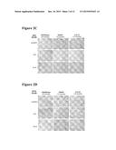 C-TERMINAL AND CENTRAL EPITOPE A-BETA ANTIBODIES diagram and image