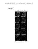 C-TERMINAL AND CENTRAL EPITOPE A-BETA ANTIBODIES diagram and image