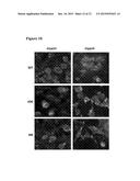 C-TERMINAL AND CENTRAL EPITOPE A-BETA ANTIBODIES diagram and image