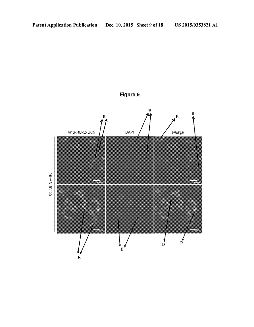 AN UPCONVERSION FLUORESCENT NANOPARTICLE - diagram, schematic, and image 10