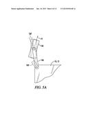 Swing Over Steering diagram and image