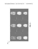 ARTERIAL SPIN LABELING WITH REDUCED ACOUSTIC NOISE EMISSIONS AND METHOD OF     OPERATION THEREOF diagram and image