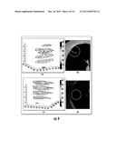 QUANTITATIVE PREDICTORS OF TUMOR SEVERITY diagram and image