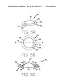 DISK DRIVE SUSPENSION ASSEMBLY HAVING A PARTIALLY FLANGELESS LOAD POINT     DIMPLE diagram and image