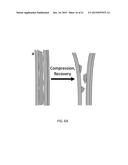 METHODS AND DEVICES FOR IN SITU SYNTHESIS OF METAL OXIDES IN CARBON     NANOTUBE ARRAYS diagram and image