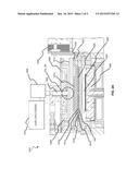 SELECTIVE TITANIUM NITRIDE REMOVAL diagram and image