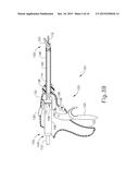 SURGICAL INSTRUMENT USAGE DATA MANAGEMENT diagram and image