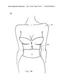 SUPPORT BUSTIER GARMENT diagram and image