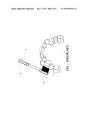 TOOTHBRUSH FOR PERIODONTAL CARE diagram and image