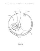 ACTIVITY AND VOLUME SENSING BEVERAGE CONTAINER CAP SYSTEM diagram and image