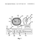 ASSESSING ENDOTHELIAL FUNCTION USING A BLOOD PRESSURE CUFF diagram and image