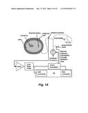 ASSESSING ENDOTHELIAL FUNCTION USING A BLOOD PRESSURE CUFF diagram and image