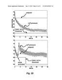 ASSESSING ENDOTHELIAL FUNCTION USING A BLOOD PRESSURE CUFF diagram and image