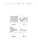 METHOD AND SYSTEM FOR SCREENING OF ATRIAL FIBRILLATION diagram and image