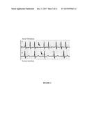 Portable Heart Motion Monitor diagram and image