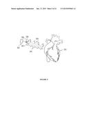 Portable Heart Motion Monitor diagram and image