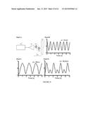 Portable Heart Motion Monitor diagram and image