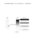 Portable Heart Motion Monitor diagram and image