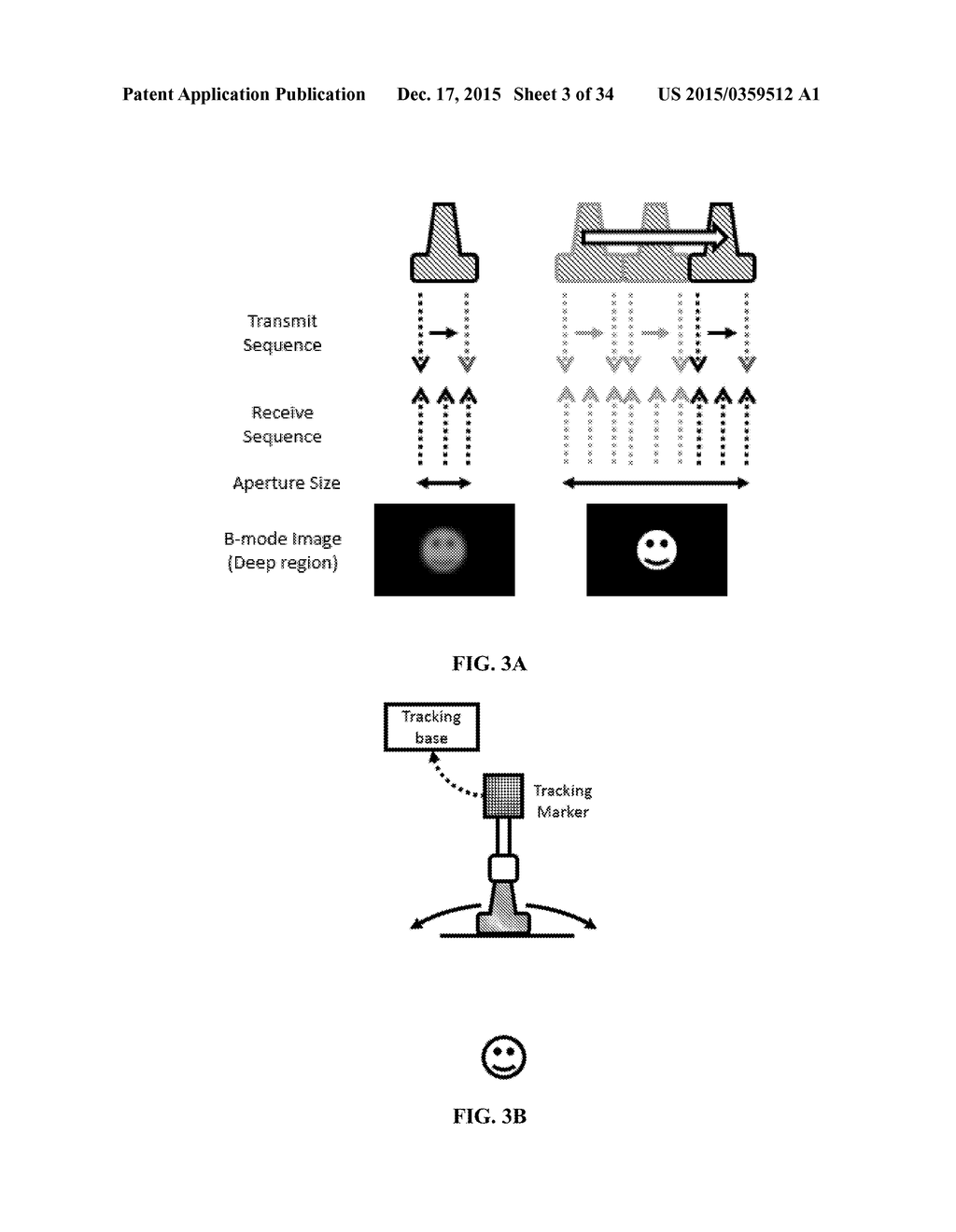 SYNTHETIC APERTURE ULTRASOUND SYSTEM - diagram, schematic, and image 04