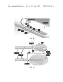 Optical guided vacuum assisted biopsy device diagram and image