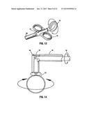 SURGICAL RETRIEVAL APPARATUS diagram and image